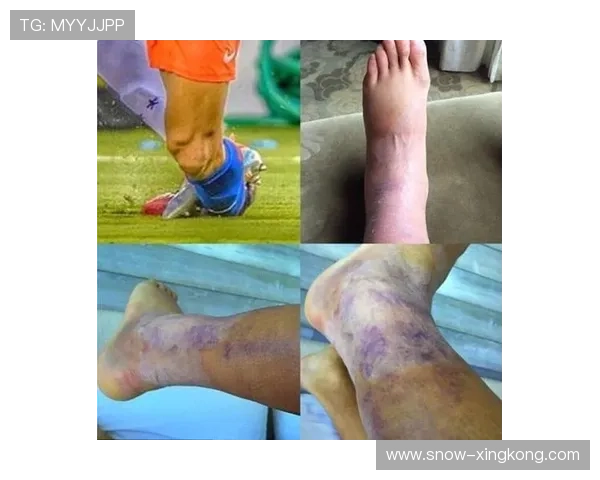 足坛因崴脚遭遇伤病困扰的知名球星及其复出故事解析